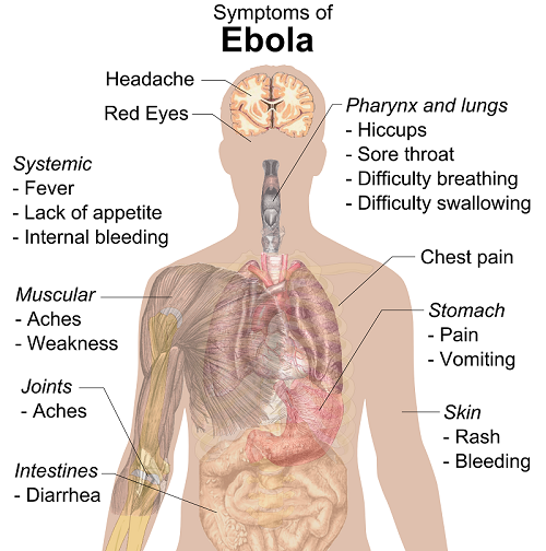 雅思写作雅思口语Ebola crisis—safety&health