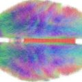 PTE阅读写作SWT训练: 神经连接体之于人类认知 Connectomes & Cognition
