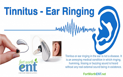 PTE听力口语-科学60秒：青少年发明药物对抗耳鸣